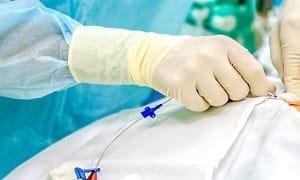 ما أسباب عودة دوالي الخصية بعد العملية؟